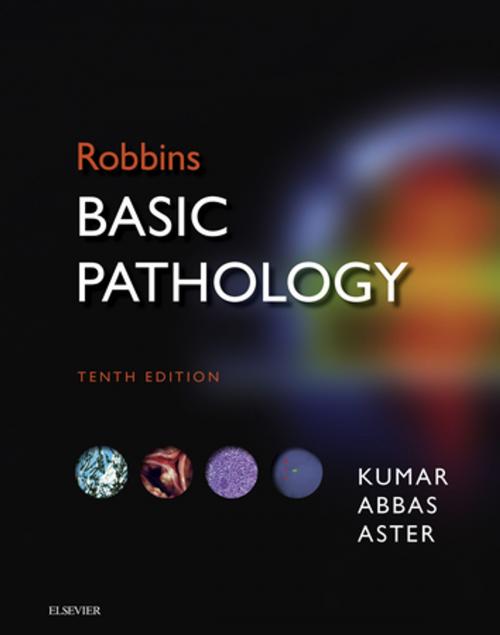 Cover of the book Robbins Basic Pathology E-Book by Vinay Kumar, MBBS, MD, FRCPath, Abul K. Abbas, MBBS, Jon C. Aster, MD, PhD, Elsevier Health Sciences