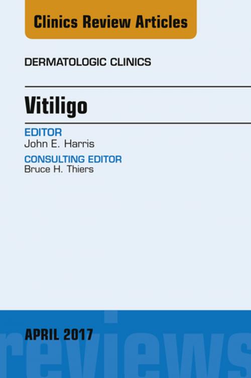 Cover of the book Vitiligo, An Issue of Dermatologic Clinics, E-Book by John E. Harris, MD, PhD, Elsevier Health Sciences