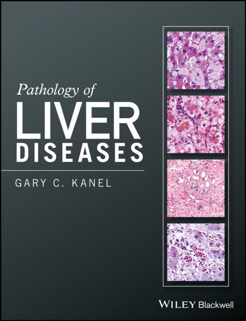 Cover of the book Pathology of Liver Diseases by Gary C. Kanel, Wiley