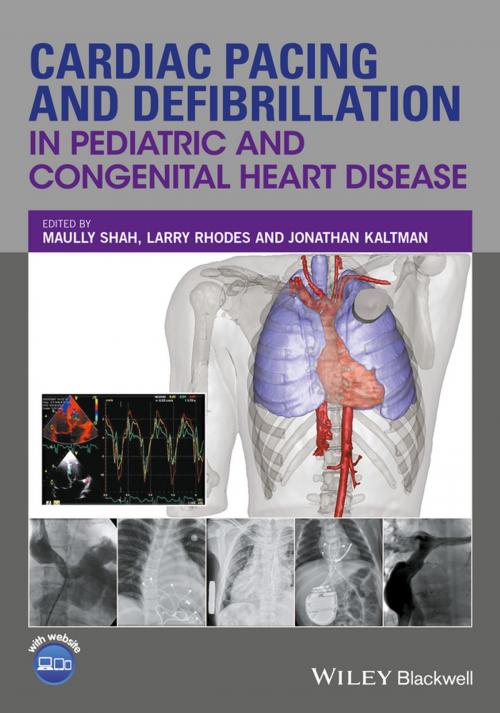 Cover of the book Cardiac Pacing and Defibrillation in Pediatric and Congenital Heart Disease by , Wiley