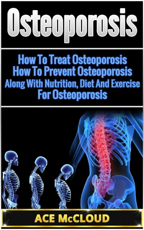 Cover of the book Osteoporosis: How To Treat Osteoporosis: How To Prevent Osteoporosis: Along With Nutrition, Diet And Exercise For Osteoporosis by Ace McCloud, Ace McCloud