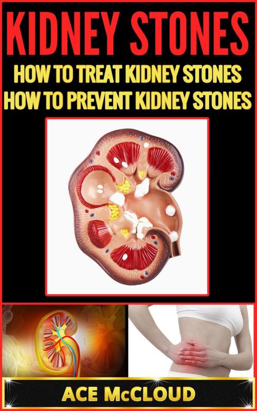 Cover of the book Kidney Stones: How To Treat Kidney Stones: How To Prevent Kidney Stones by Ace McCloud, Pro Mastery Publishing