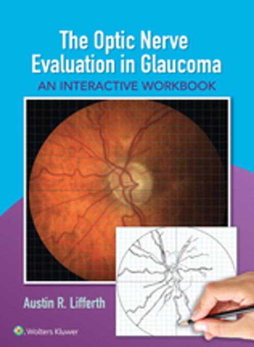 Cover of the book The Optic Nerve Evaluation in Glaucoma by Austin Lifferth, Wolters Kluwer Health
