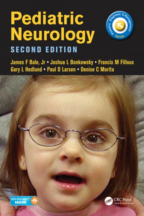 Cover of the book Pediatric Neurology by James Bale, Joshua Bonkowsky, Francis Filloux, Gary Hedlund, Paul Larsen, Denise Morita, CRC Press