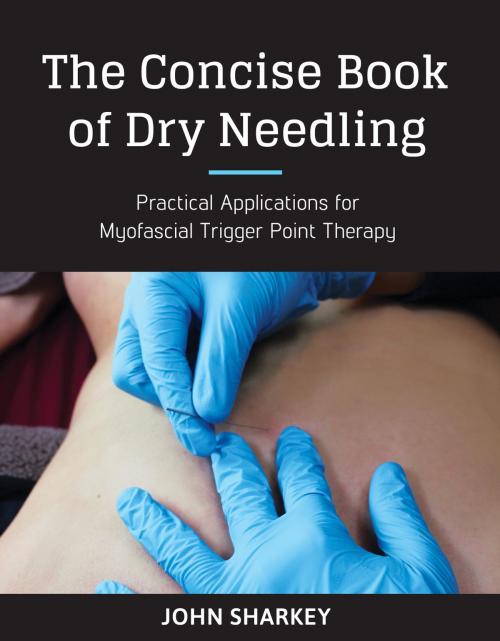 Cover of the book The Concise Book of Dry Needling by John Sharkey, North Atlantic Books