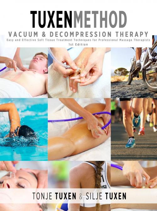 Cover of the book TuxenMethod Vacuum & Decompression Therapy by Tonje Tuxen, Silje Tuxen, Helheten AS