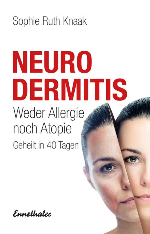 Cover of the book Neurodermitis by Sophie Ruth Knaak, Ennsthaler
