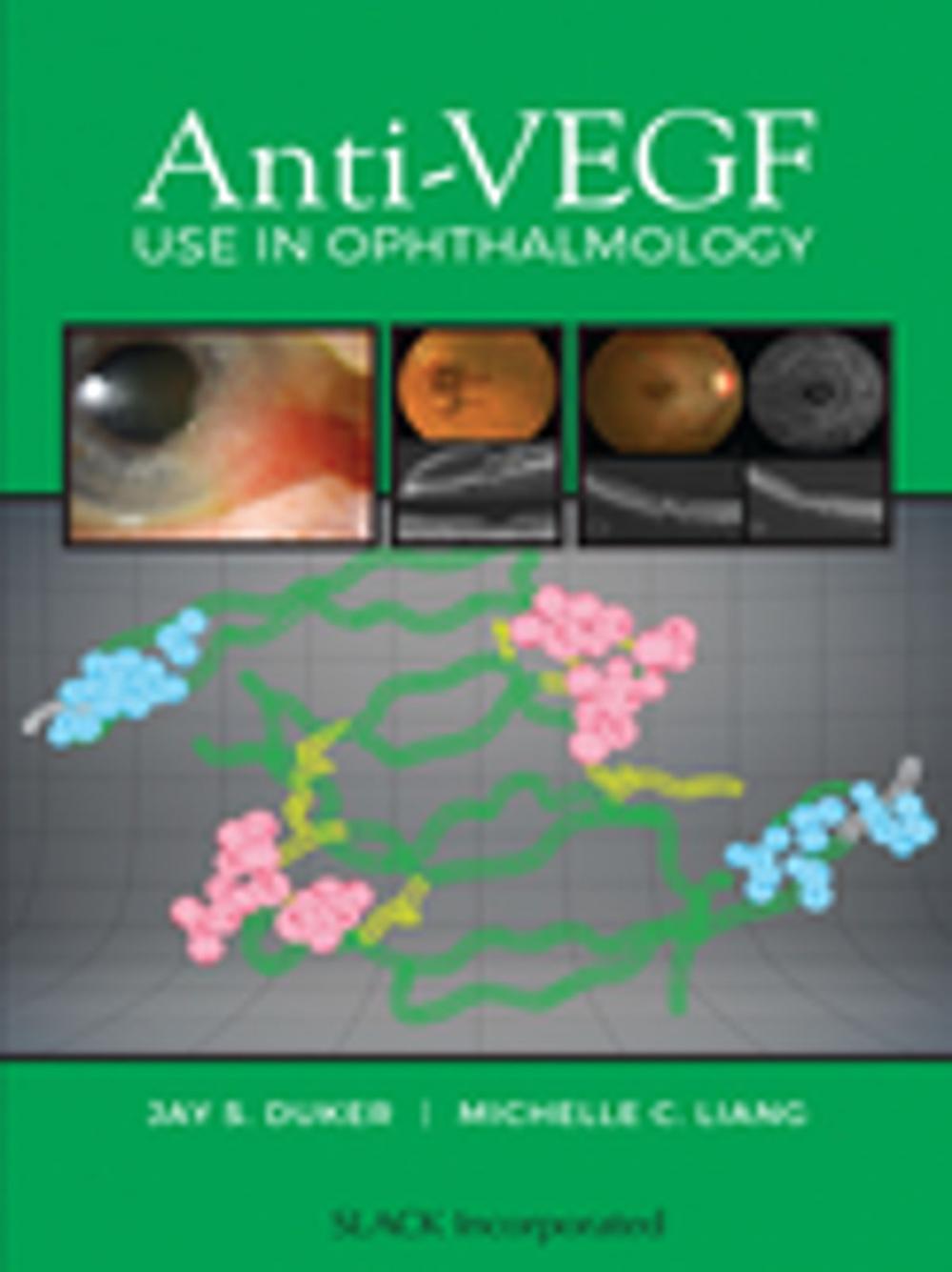 Big bigCover of Anti-VEGF Use in Ophthalmology