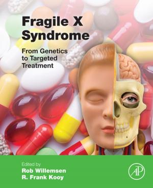 Cover of the book Fragile X Syndrome by Daniel Câmara