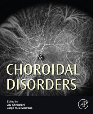 Cover of the book Choroidal Disorders by Robert Luther, T Colwyn Jones, Astrid Saxl