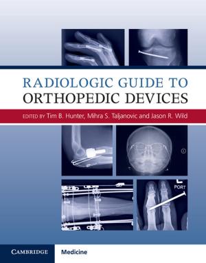 Cover of the book Radiologic Guide to Orthopedic Devices by William Twining, David Miers