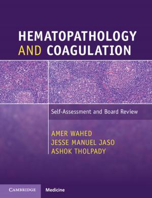 Cover of the book Hematopathology and Coagulation by Markus Daechsel