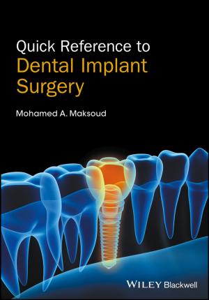Cover of the book Quick Reference to Dental Implant Surgery by Professor Gregoire Mariethoz, Jef Caers