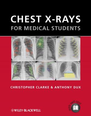 Cover of the book Chest X-rays for Medical Students by Allen Elkin