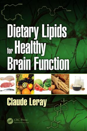 Cover of the book Dietary Lipids for Healthy Brain Function by Suzanne Somers