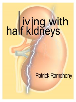 Cover of the book Living with Half Kidneys by David Nordmark