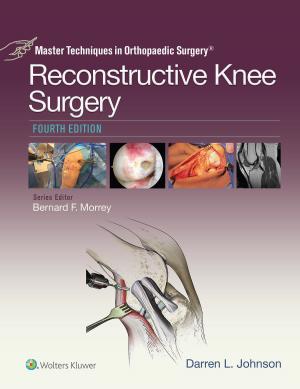 Cover of the book Master Techniques in Orthopaedic Surgery: Reconstructive Knee Surgery by Stanley Hoppenfeld, Piet de Boer, Richard Buckley