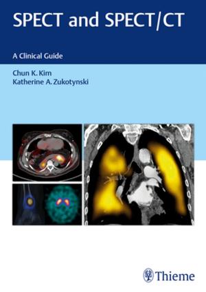 Cover of the book SPECT and SPECT/CT by Todd S. Ellenbecker