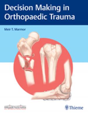 Book cover of Decision Making in Orthopaedic Trauma