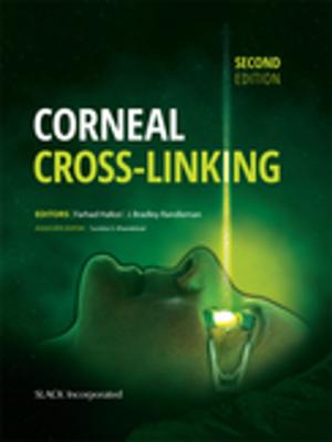 bigCover of the book Corneal Cross-Linking, Second Edition by 