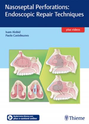 Cover of the book Nasoseptal Perforations: Endoscopic Repair Techniques by Pere Abelló
