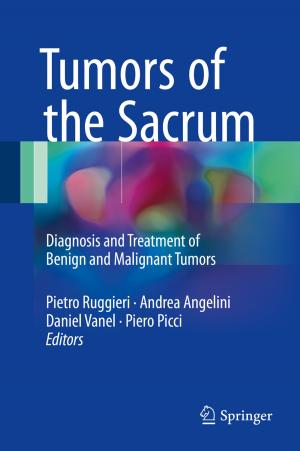 Cover of the book Tumors of the Sacrum by Angela Creditt, Jordan Tozer, Michael Vitto, Michael Joyce, Lindsay Taylor