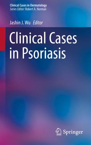 Cover of the book Clinical Cases in Psoriasis by David Holcman, Zeev Schuss