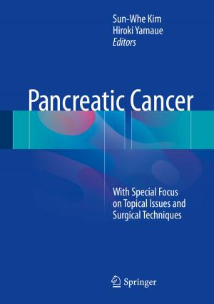 Cover of the book Pancreatic Cancer by Peter Itzel, Karin Schwall