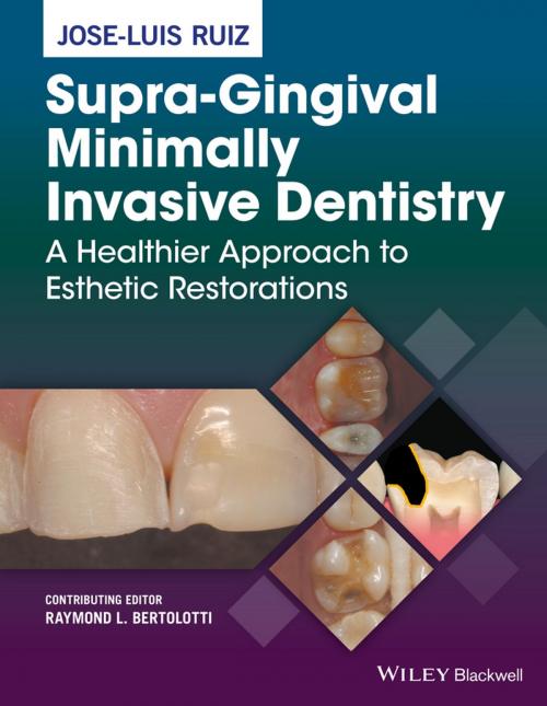 Cover of the book Supra-Gingival Minimally Invasive Dentistry by Jose-Luis Ruiz, Wiley