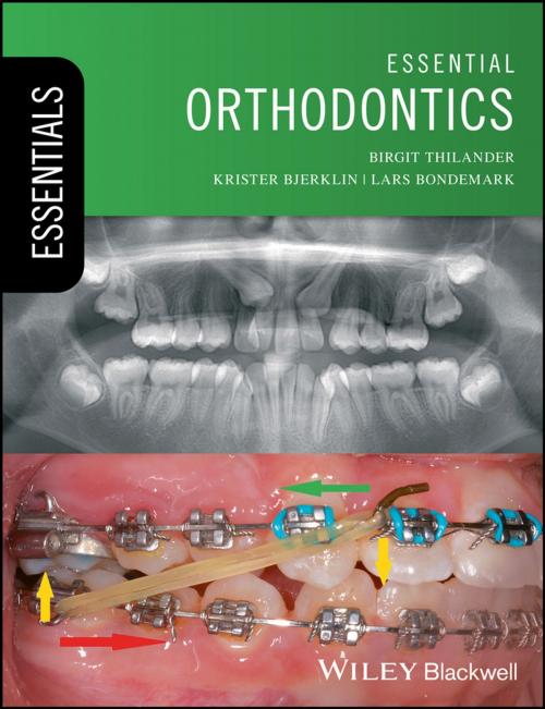 Cover of the book Essential Orthodontics by Birgit Thilander, Krister Bjerklin, Lars Bondemark, Wiley