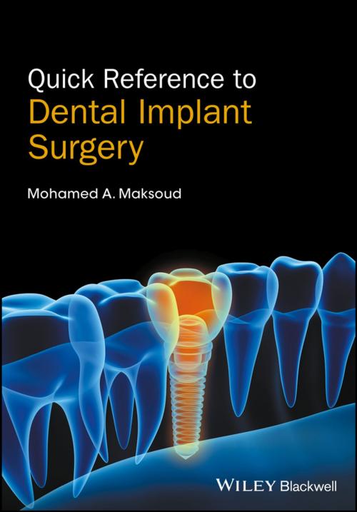 Cover of the book Quick Reference to Dental Implant Surgery by Mohamed A. Maksoud, Wiley