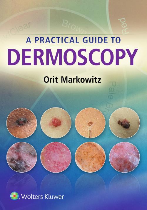 Cover of the book A Practical Guide to Dermoscopy by Orit Markowitz, Wolters Kluwer Health