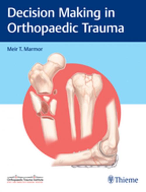 Cover of the book Decision Making in Orthopaedic Trauma by Meir Marmor, Thieme