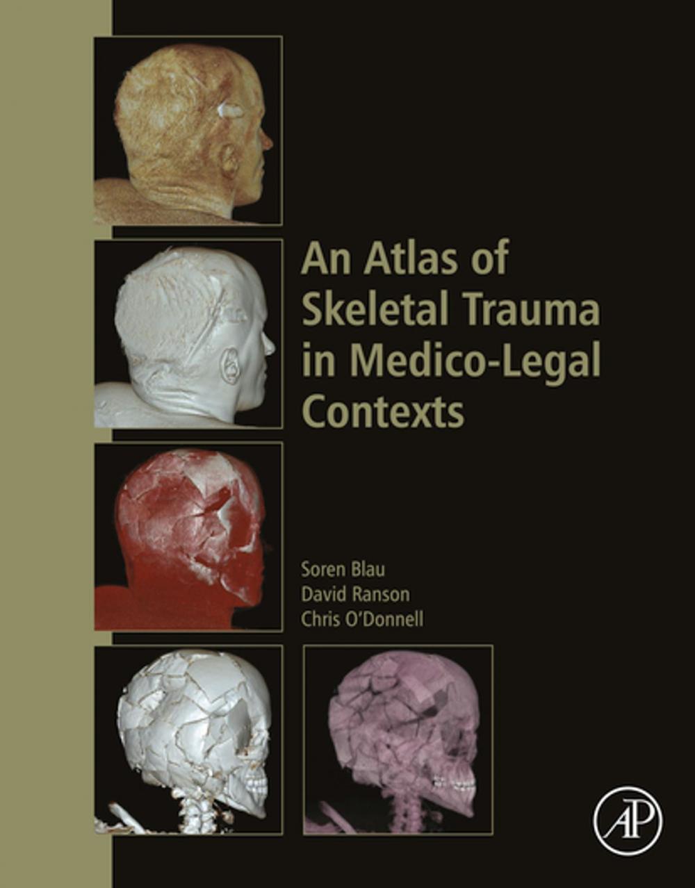 Big bigCover of An Atlas of Skeletal Trauma in Medico-Legal Contexts