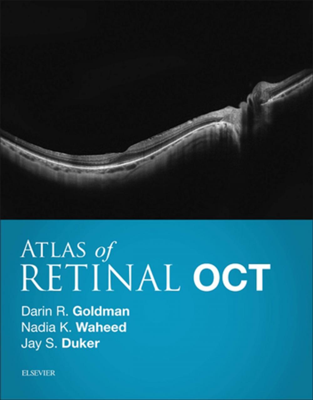 Big bigCover of Atlas of Retinal OCT E-Book
