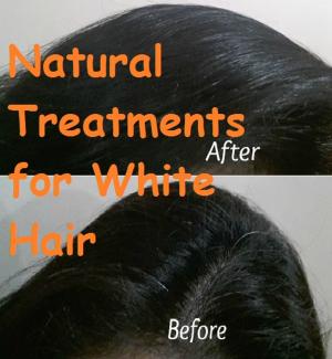 Cover of the book Natural Treatments for White Hair by Jennifer Stepanik