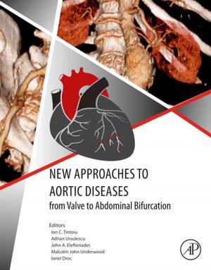 Cover of the book New Approaches to Aortic Diseases from Valve to Abdominal Bifurcation by Maciej Pietrzyk, Ph.D., Lukasz Madej, Ph.D., Lukasz Rauch, Ph.D., Danuta Szeliga, Ph.D.