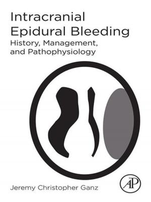 Cover of the book Intracranial Epidural Bleeding by Melvin I. Simon, Brian Crane, Alexandrine Crane