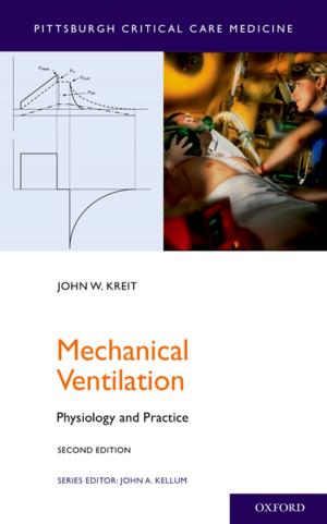 Book cover of Mechanical Ventilation