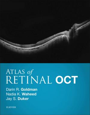 Book cover of Atlas of Retinal OCT E-Book