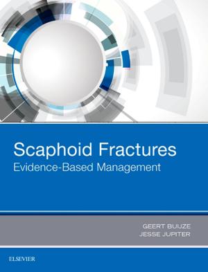Cover of the book Scaphoid Fractures by Roger Haertl, Andreas Korge