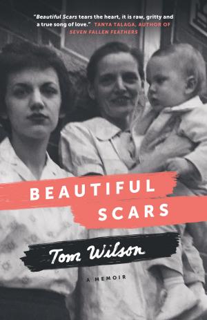 Book cover of Beautiful Scars
