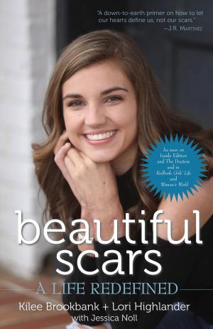 Cover of the book Beautiful Scars by Human Angels