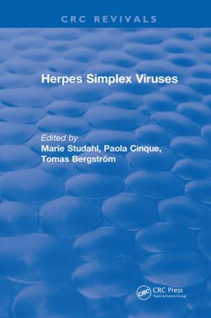 Cover of the book Herpes Simplex Viruses by Mehrdad Ehsani, Yimin Gao, Stefano Longo, Kambiz Ebrahimi