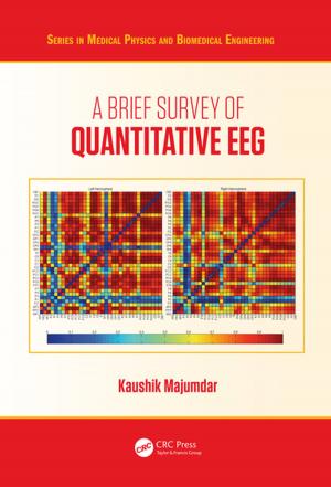 Cover of the book A Brief Survey of Quantitative EEG by Maurice L. Adams