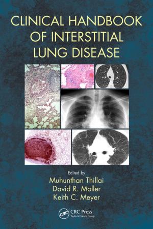 Cover of the book Clinical Handbook of Interstitial Lung Disease by Oliver F. Lehmann
