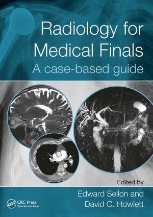 Cover of the book Radiology for Medical Finals by Richard W. Solarz