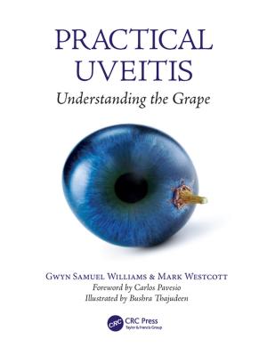 Book cover of Practical Uveitis
