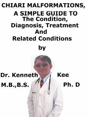 Cover of the book Chiari Malformations, A Simple Guide To The Condition, Diagnosis, Treatment And Related Conditions by Kenneth Kee