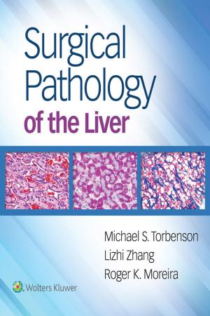 Cover of the book Surgical Pathology of the Liver by Larry Kaiser, Irving L. Kron, Thomas L. Spray